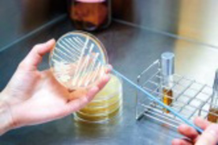 東京農業大学 食の安全・安心を守るために必要な方法やルールを理論的に学びます。（分子微生物学科）